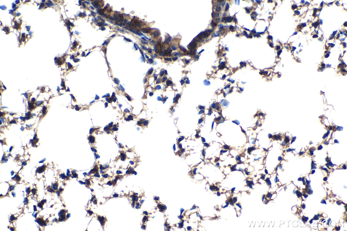 Immunohistochemical analysis of paraffin-embedded mouse lung tissue slide using KHC2100 (DIAPH1 IHC Kit).