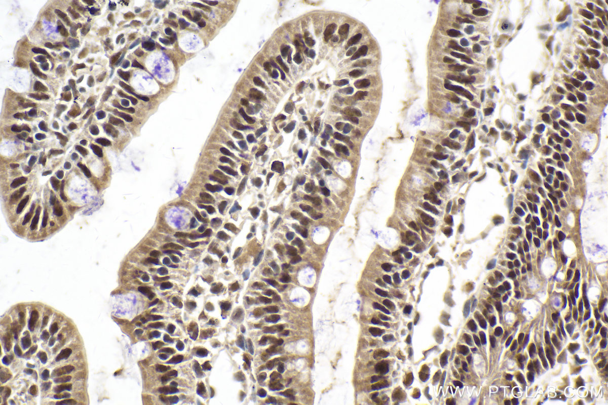 Immunohistochemical analysis of paraffin-embedded rat small intestine tissue slide using KHC2015 (DIS3 IHC Kit).