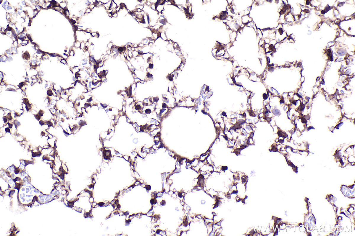 Immunohistochemical analysis of paraffin-embedded mouse lung tissue slide using KHC2412 (DLG1 IHC Kit).