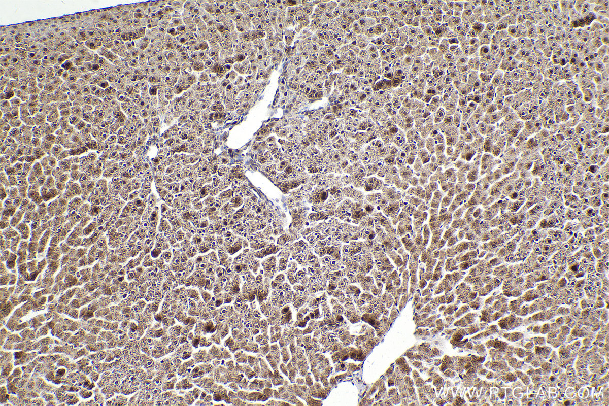 Immunohistochemical analysis of paraffin-embedded rat liver tissue slide using KHC2199 (LIG1 IHC Kit).