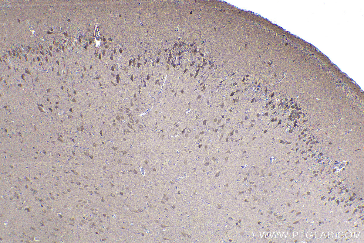 Immunohistochemical analysis of paraffin-embedded rat brain tissue slide using KHC2234 (DNAJA1 IHC Kit).