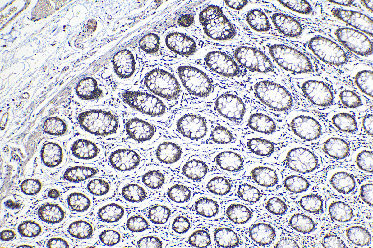 Immunohistochemical analysis of paraffin-embedded human colon tissue slide using KHC1129 (DNAJC9 IHC Kit).