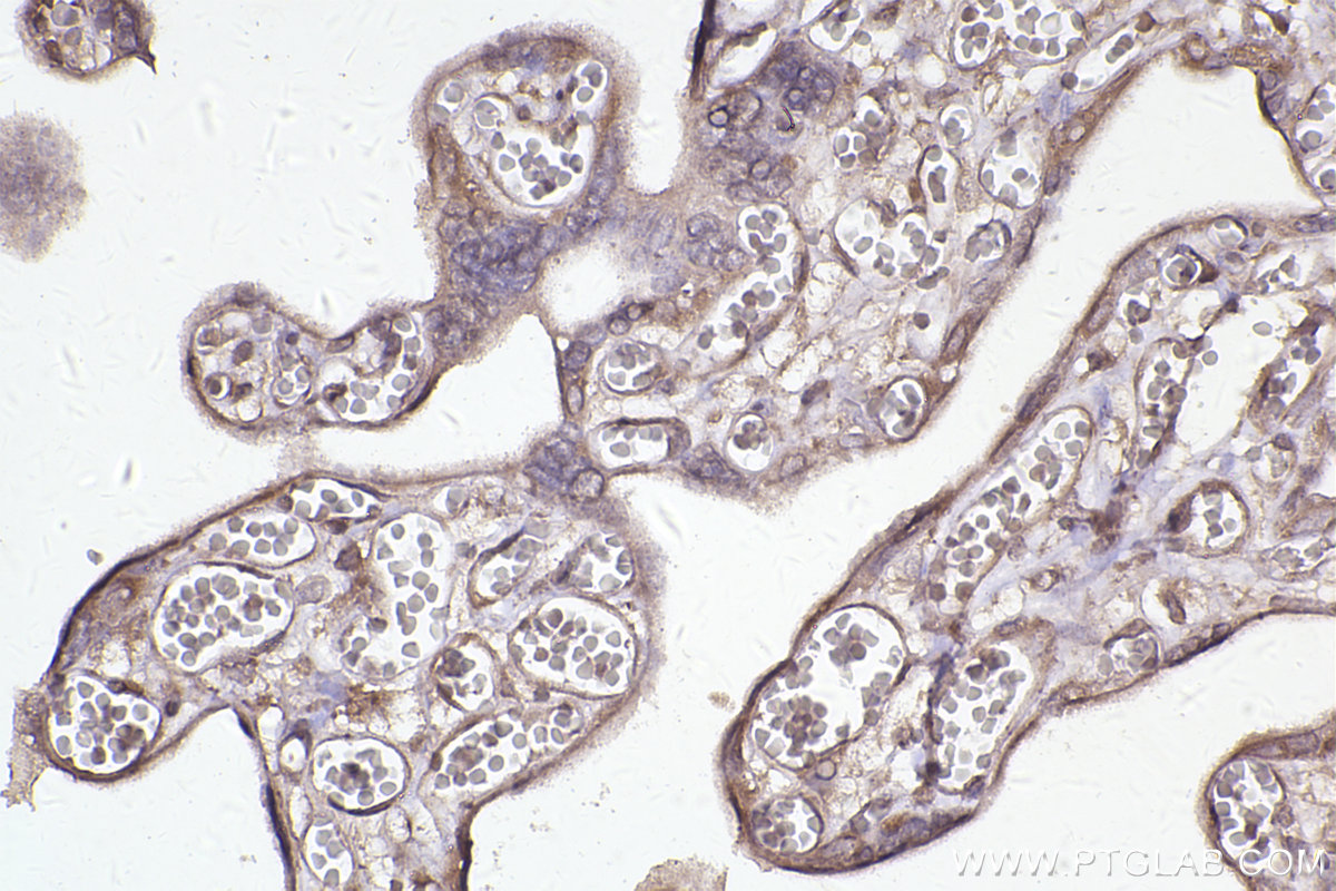 Immunohistochemical analysis of paraffin-embedded human placenta tissue slide using KHC2454 (DOCK1 IHC Kit).