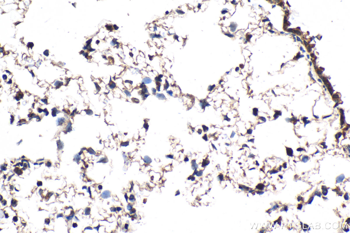 Immunohistochemical analysis of paraffin-embedded rat lung tissue slide using KHC2103 (DPM1 IHC Kit).