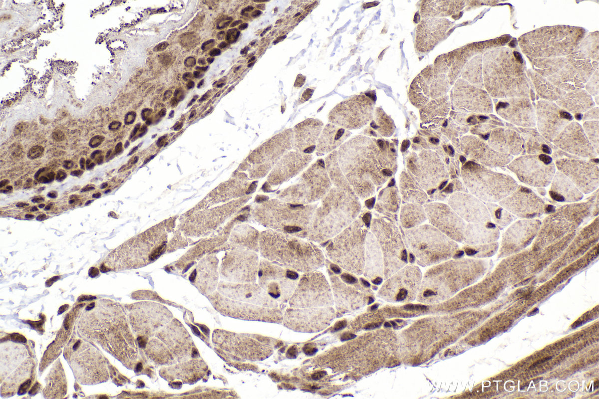 Immunohistochemical analysis of paraffin-embedded mouse esophagus tissue slide using KHC2239 (DUT IHC Kit).