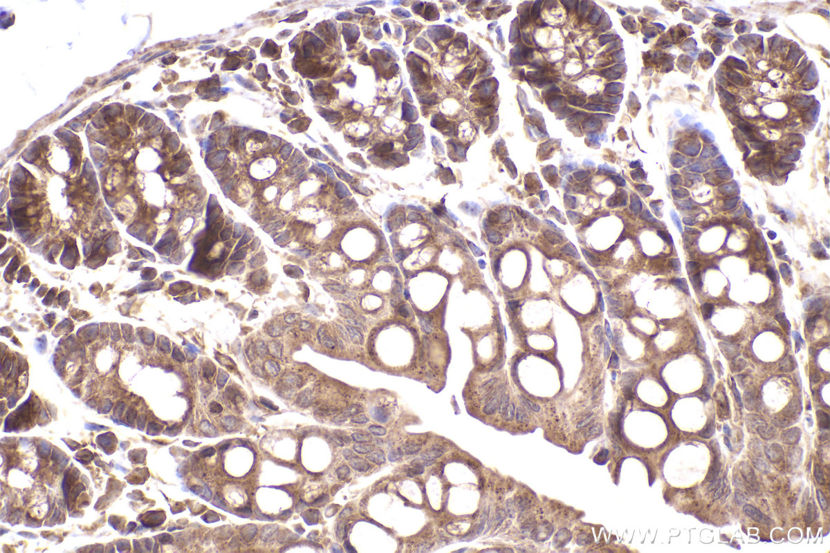 Immunohistochemical analysis of paraffin-embedded mouse colon tissue slide using KHC2455 (DYNC1H1 IHC Kit).