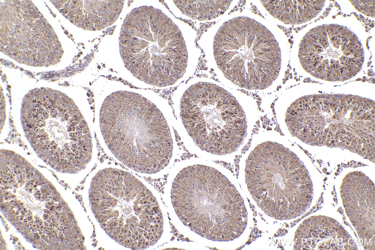 Immunohistochemical analysis of paraffin-embedded rat testis tissue slide using KHC2455 (DYNC1H1 IHC Kit).