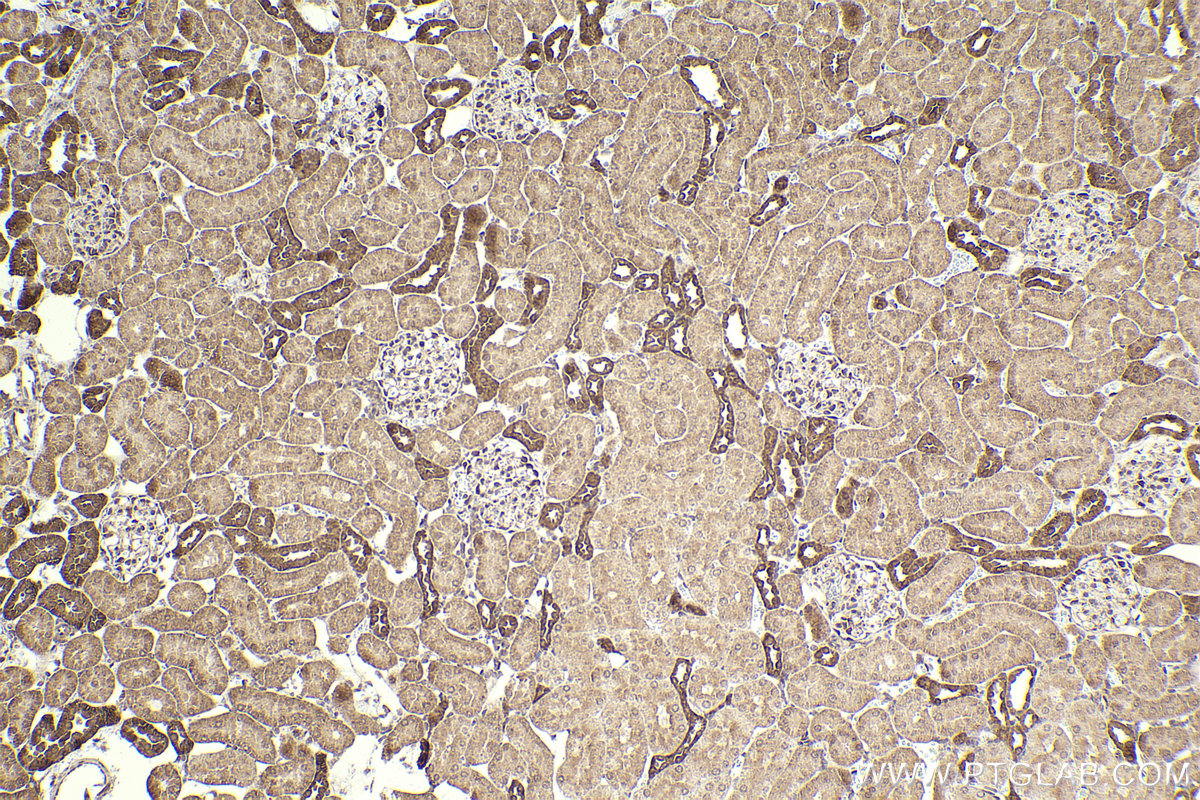 Immunohistochemical analysis of paraffin-embedded rat kidney tissue slide using KHC2306 (DYNLT3 IHC Kit).