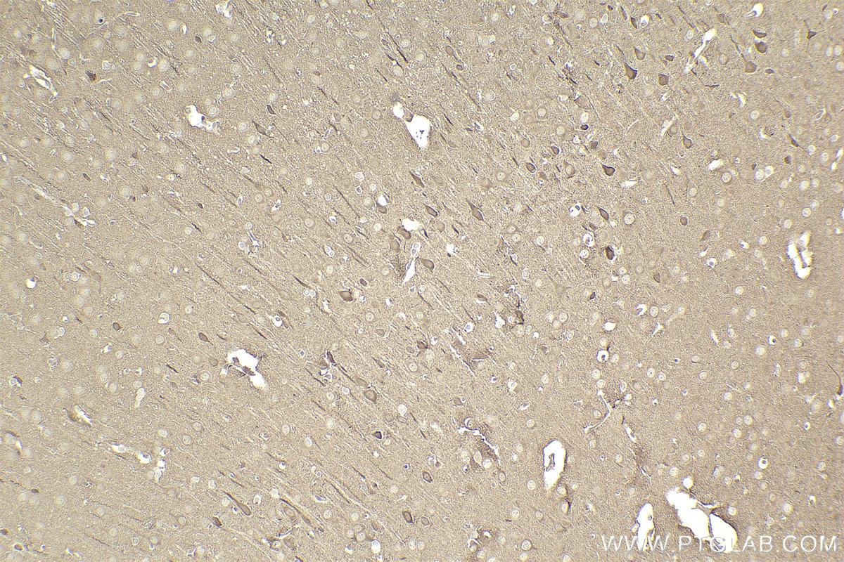 Immunohistochemical analysis of paraffin-embedded rat brain tissue slide using KHC2306 (DYNLT3 IHC Kit).