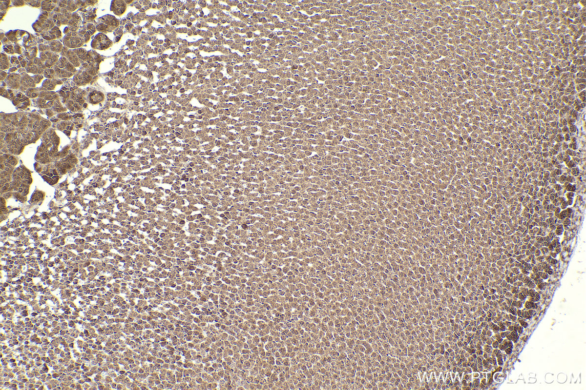 Immunohistochemical analysis of paraffin-embedded rat adrenal gland tissue slide using KHC2306 (DYNLT3 IHC Kit).