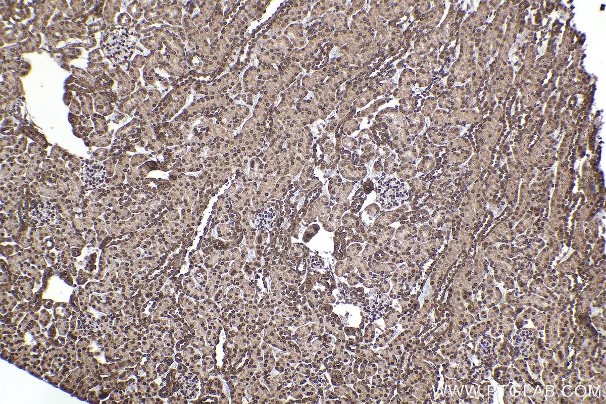 Immunohistochemical analysis of paraffin-embedded mouse kidney tissue slide using KHC2306 (DYNLT3 IHC Kit).