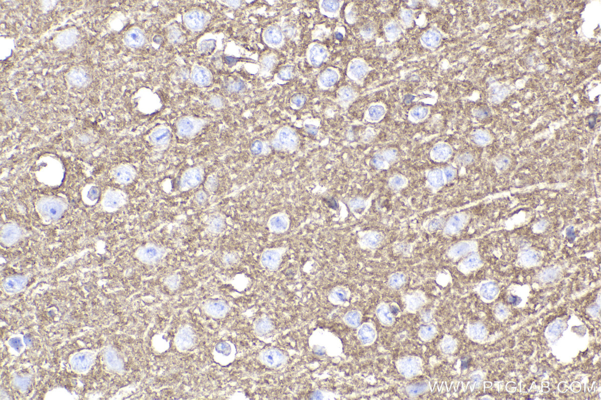 Immunohistochemical analysis of paraffin-embedded mouse brain tissue slide using KHC2269 (EAAT2/SLC1A2 IHC Kit).