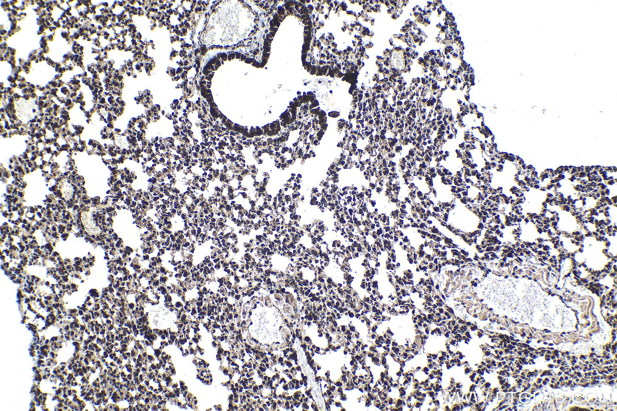 Immunohistochemical analysis of paraffin-embedded mouse lung tissue slide using KHC1469 (EDF1 IHC Kit).