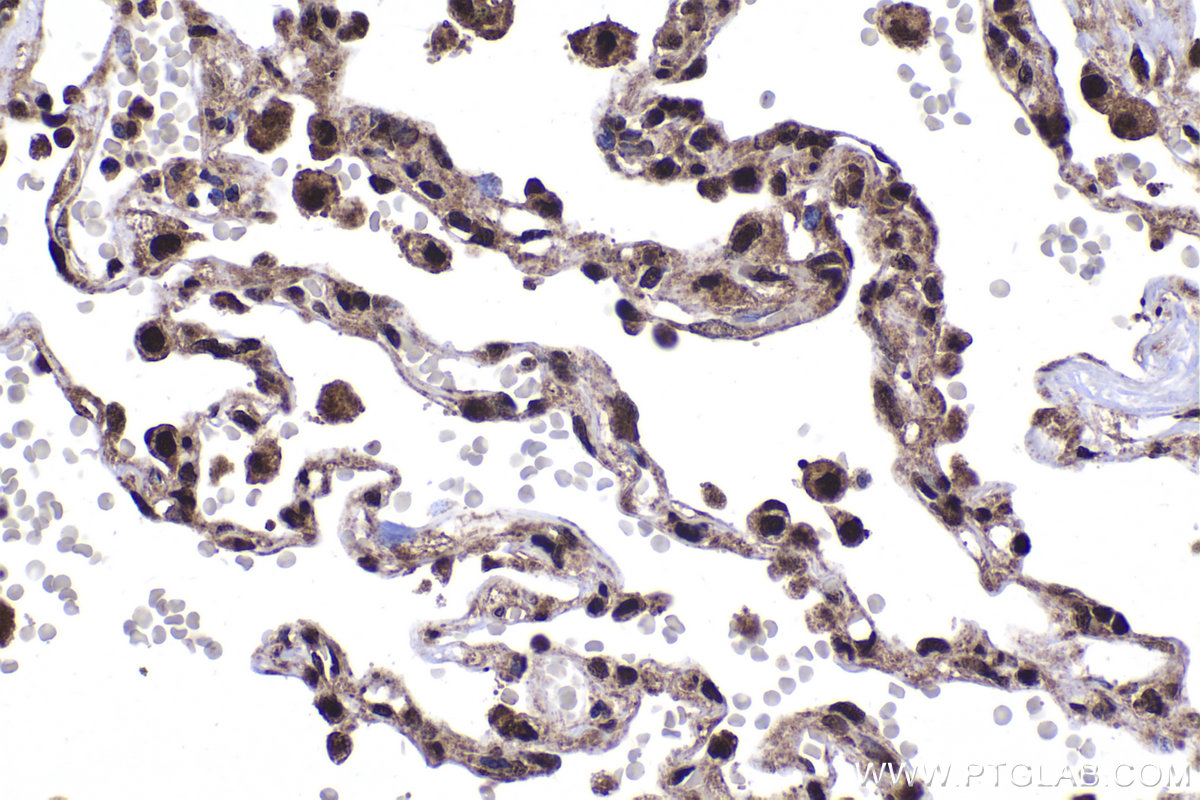 Immunohistochemical analysis of paraffin-embedded human lung tissue slide using KHC2032 (EID1 IHC Kit).