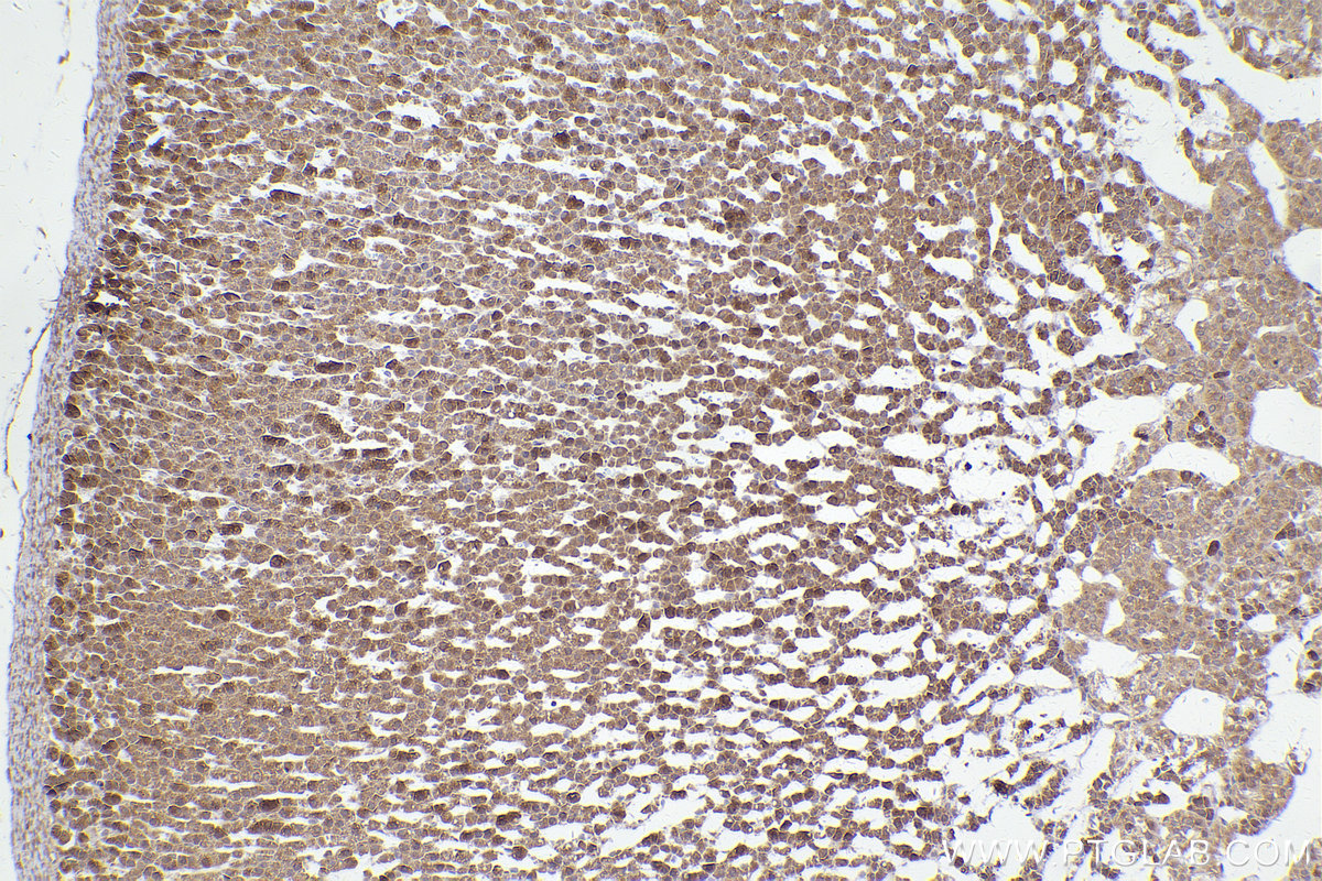 Immunohistochemical analysis of paraffin-embedded rat adrenal gland tissue slide using KHC2418 (EIF2B5 IHC Kit).