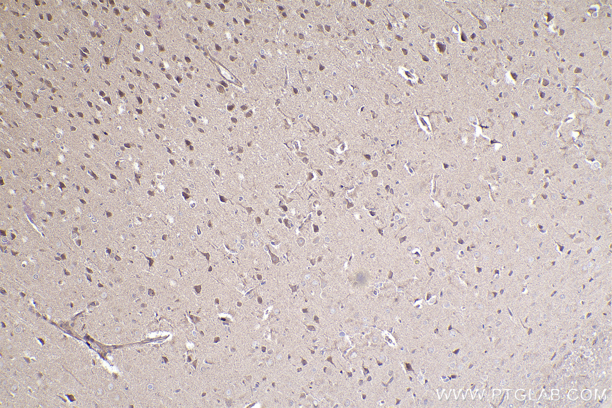 Immunohistochemical analysis of paraffin-embedded rat brain tissue slide using KHC2327 (EIF5 IHC Kit).