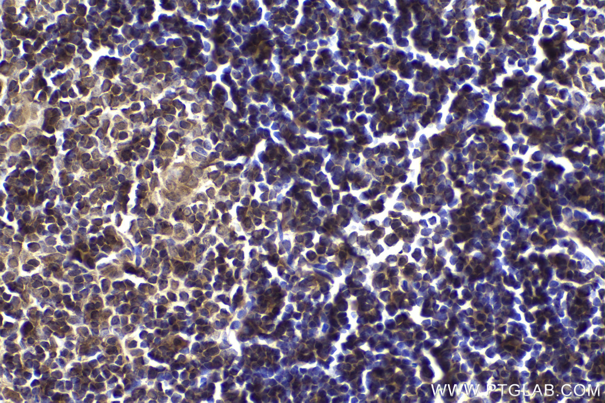 Immunohistochemical analysis of paraffin-embedded mouse thymus tissue slide using KHC2177 (EPB41 IHC Kit).