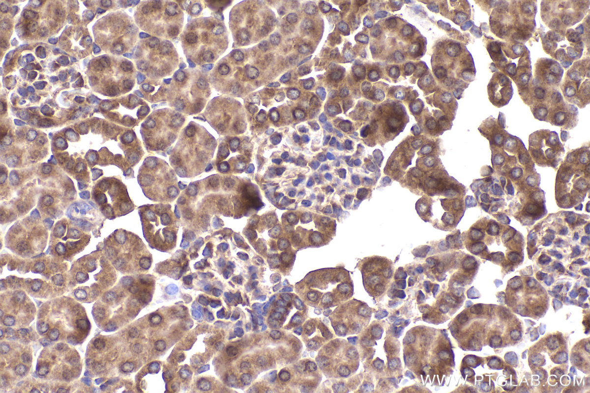 Immunohistochemical analysis of paraffin-embedded mouse kidney tissue slide using KHC2326 (EPHB4 IHC Kit).