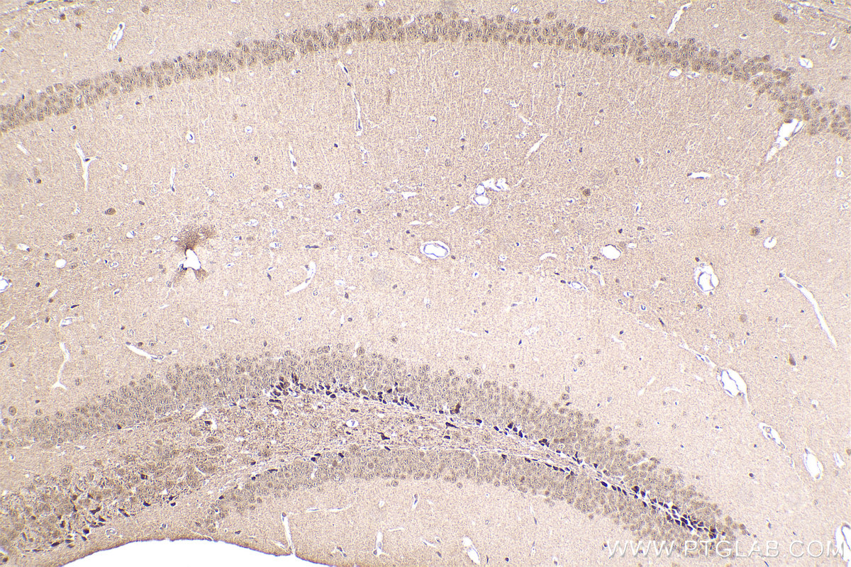 Immunohistochemical analysis of paraffin-embedded mouse brain tissue slide using KHC2197 (ERCC2 IHC Kit).