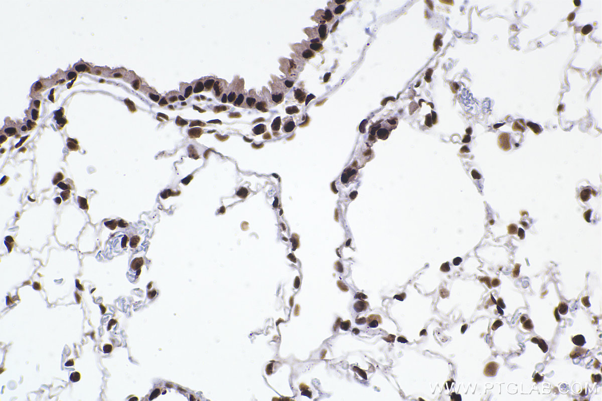 Immunohistochemical analysis of paraffin-embedded mouse lung tissue slide using KHC2373 (ERH IHC Kit).