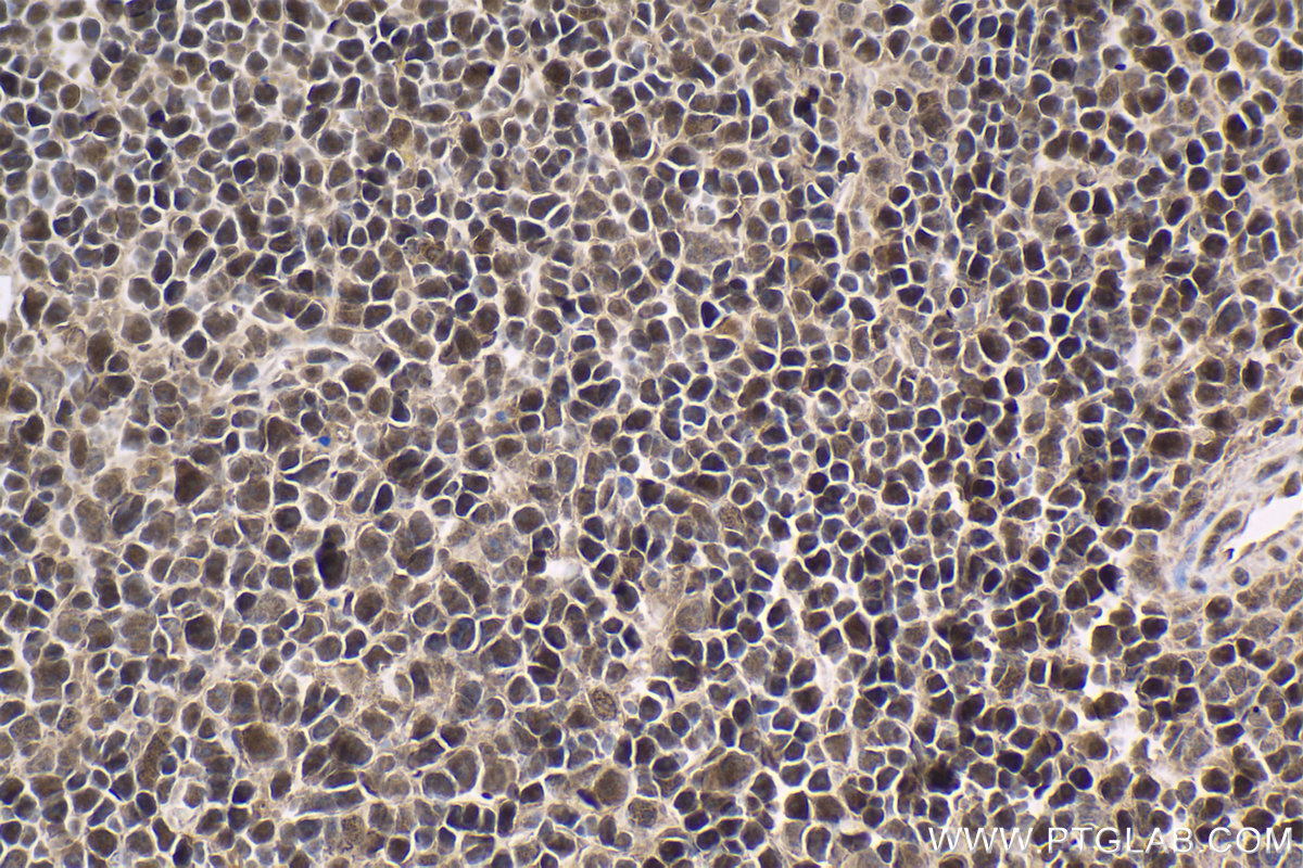 Immunohistochemical analysis of paraffin-embedded mouse spleen tissue slide using KHC1533 (ETS1 IHC Kit).
