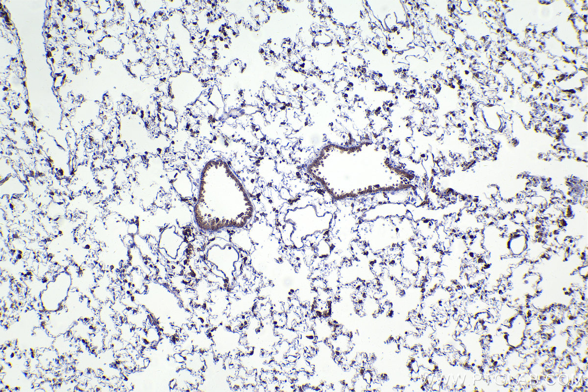 Immunohistochemical analysis of paraffin-embedded rat lung tissue slide using KHC2242 (EVI2B IHC Kit).