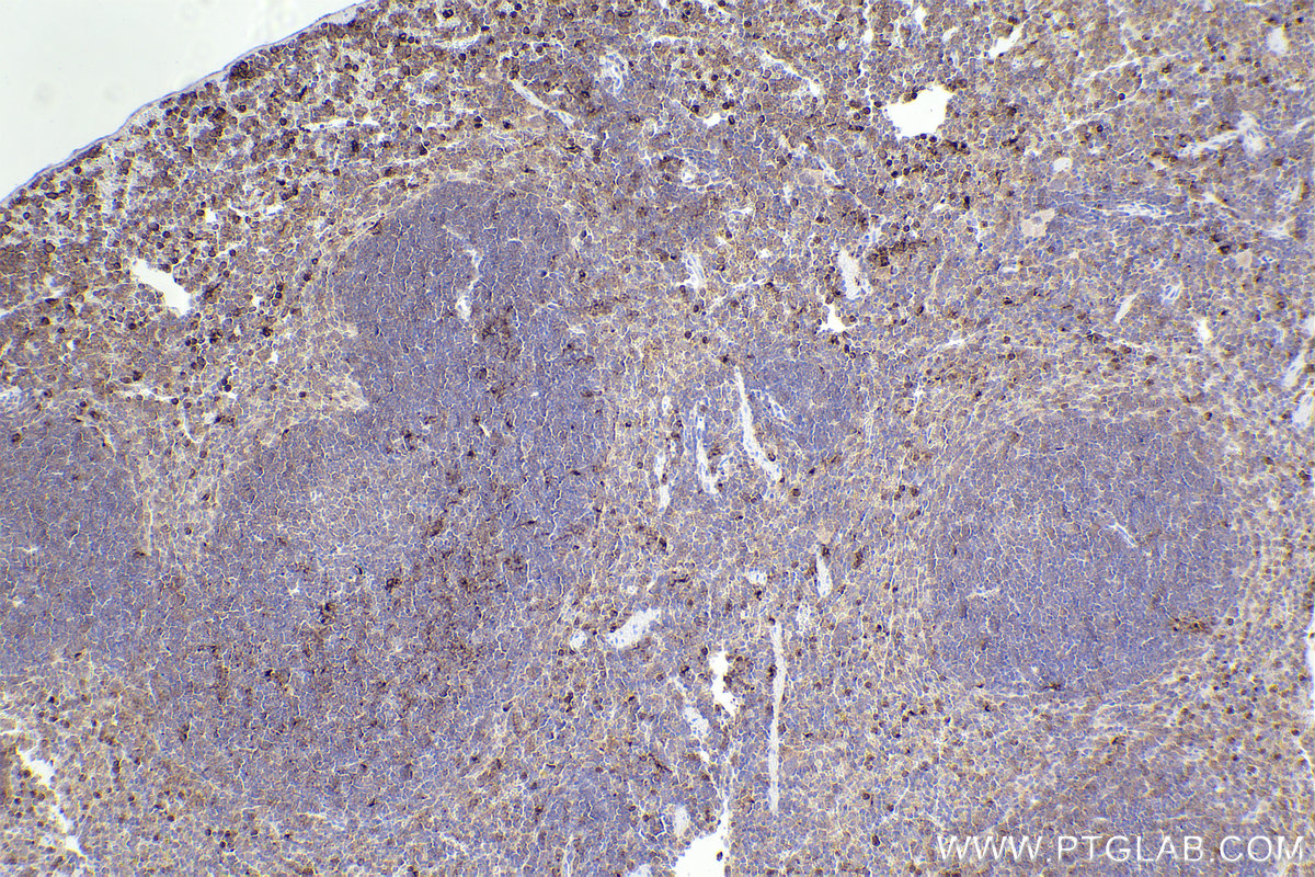 Immunohistochemical analysis of paraffin-embedded mouse spleen tissue slide using KHC2242 (EVI2B IHC Kit).