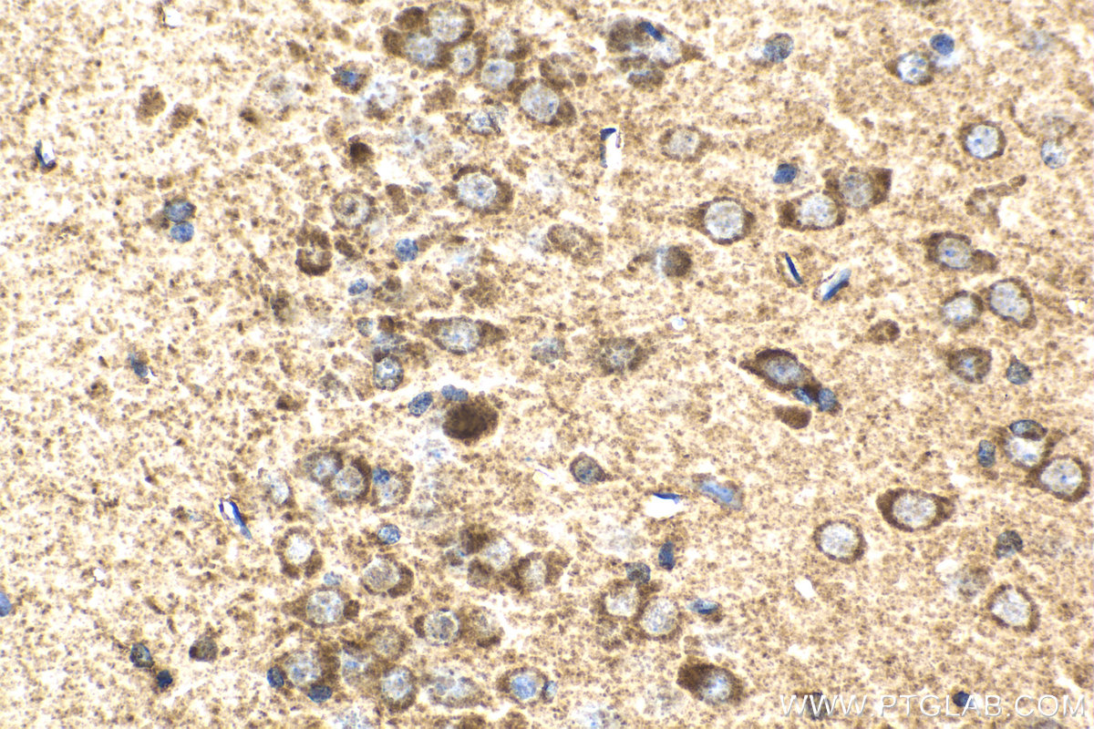 Immunohistochemical analysis of paraffin-embedded rat brain tissue slide using KHC2046 (EXOC5 IHC Kit).