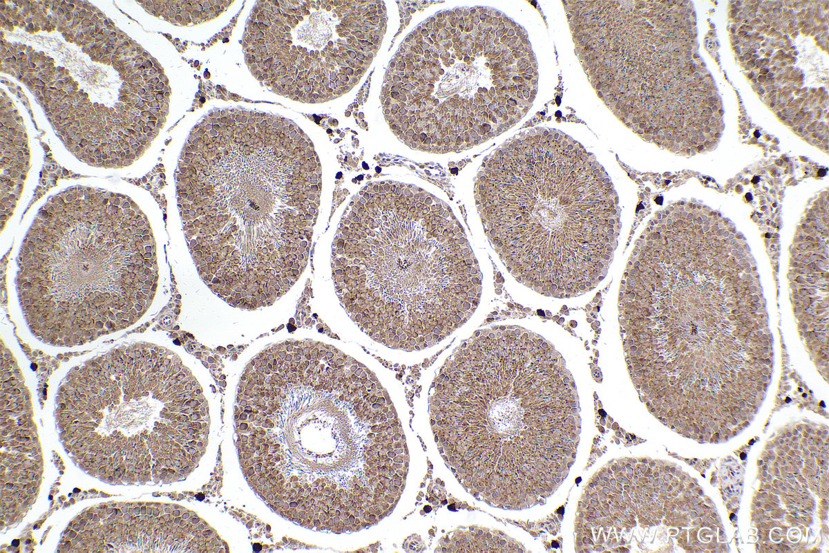 Immunohistochemical analysis of paraffin-embedded rat testis tissue slide using KHC2409 (FAP IHC Kit).