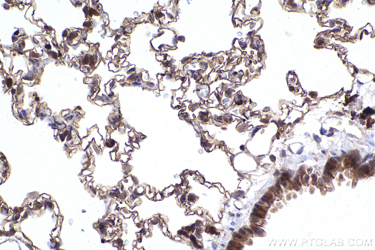 Immunohistochemical analysis of paraffin-embedded rat lung tissue slide using KHC2409 (FAP IHC Kit).