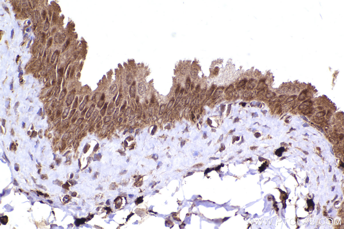 Immunohistochemical analysis of paraffin-embedded rat bladder tissue slide using KHC2409 (FAP IHC Kit).