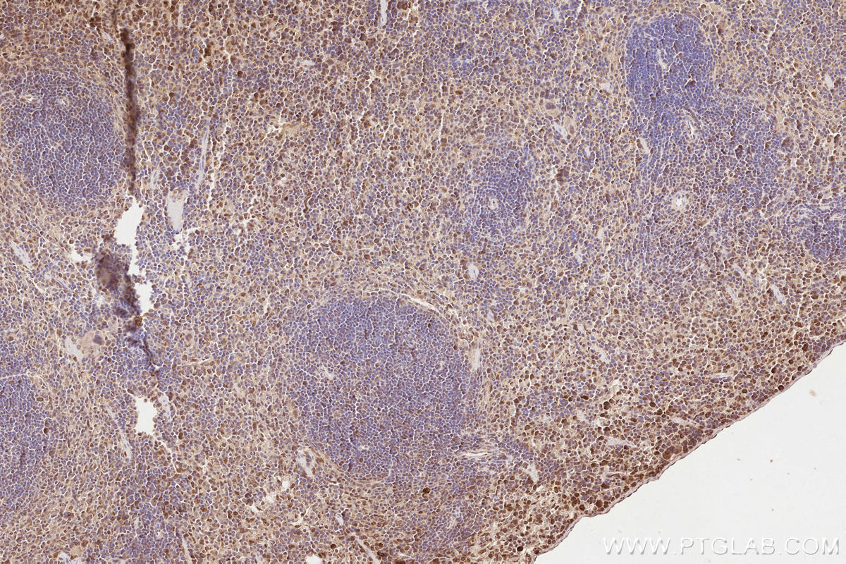 Immunohistochemical analysis of paraffin-embedded mouse spleen tissue slide using KHC2567 (FBXO31 IHC Kit).