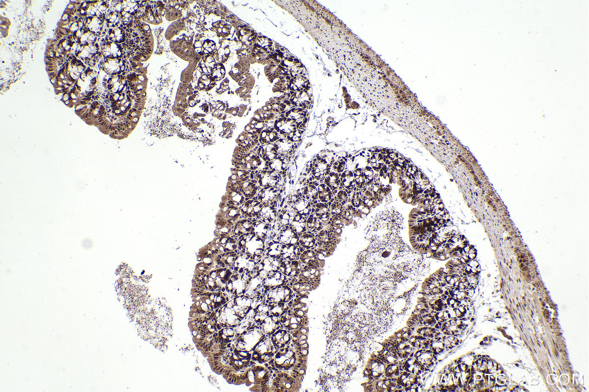 Immunohistochemical analysis of paraffin-embedded mouse small intestine tissue slide using KHC2256 (FEN1 IHC Kit).