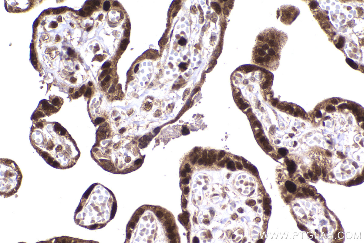 Immunohistochemical analysis of paraffin-embedded human placenta tissue slide using KHC2256 (FEN1 IHC Kit).