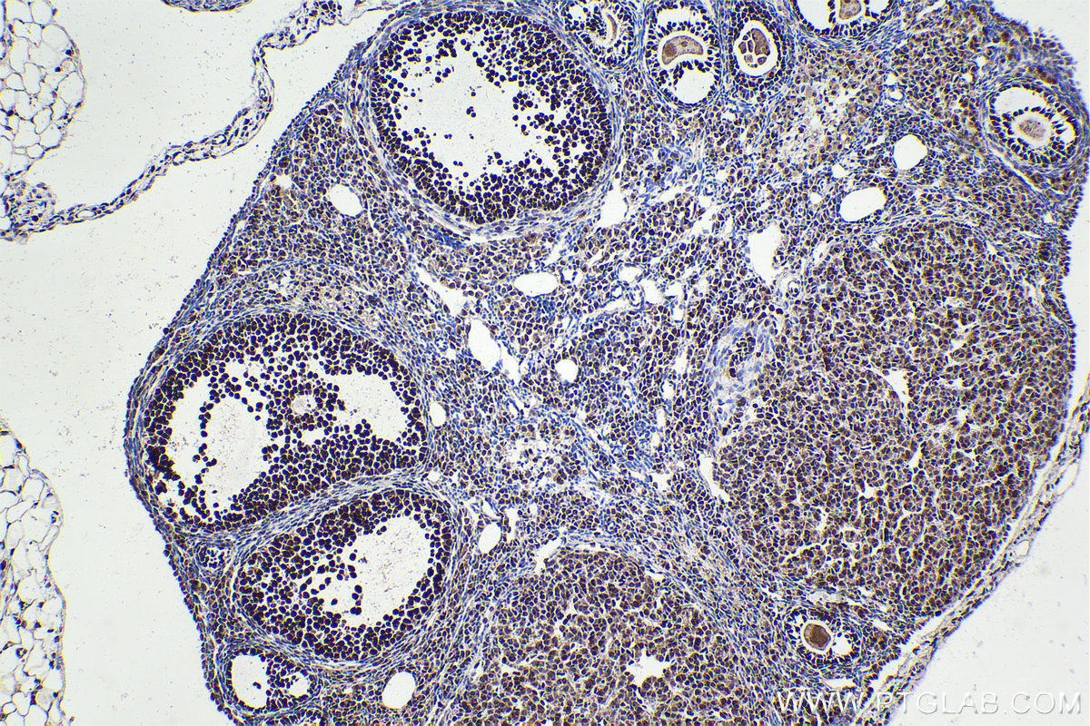 Immunohistochemical analysis of paraffin-embedded mouse ovary tissue slide using KHC2256 (FEN1 IHC Kit).