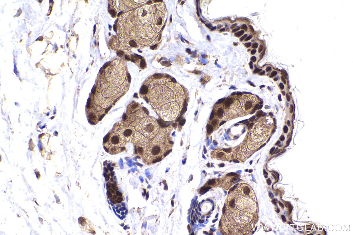 Immunohistochemical analysis of paraffin-embedded mouse skin tissue slide using KHC2256 (FEN1 IHC Kit).