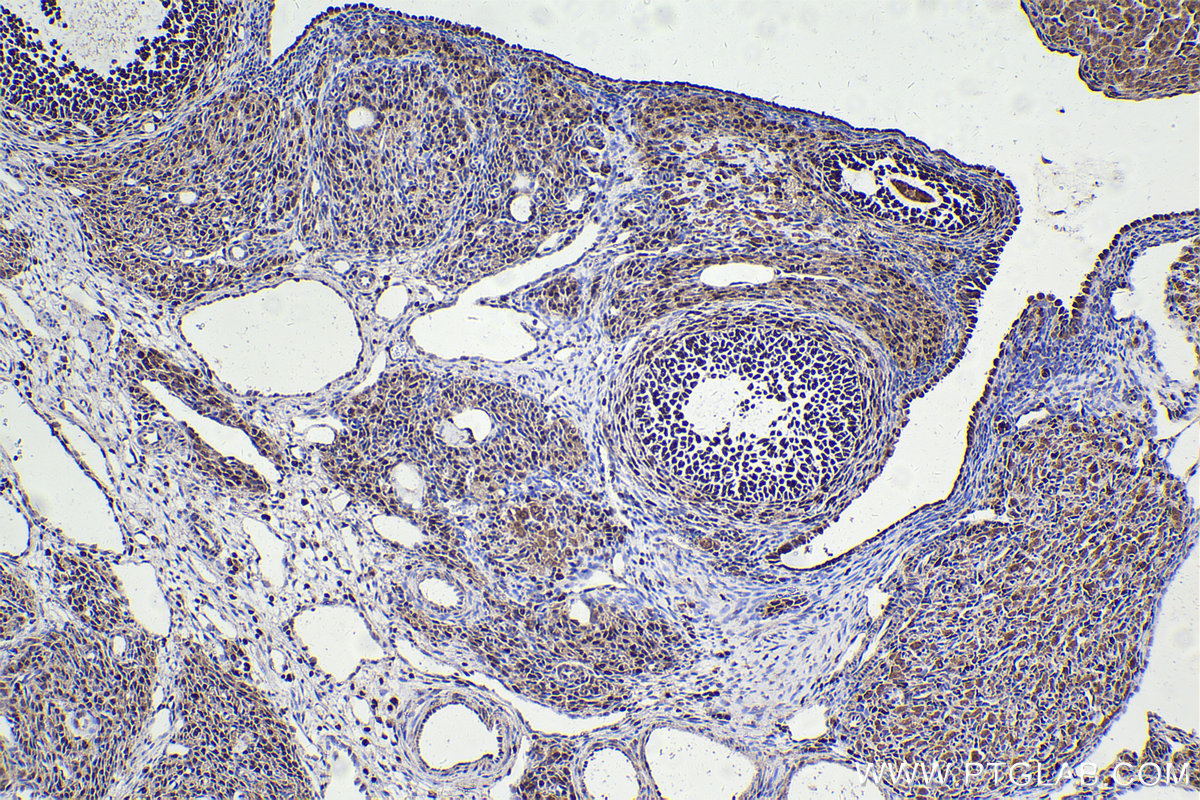 Immunohistochemical analysis of paraffin-embedded rat ovary tissue slide using KHC2256 (FEN1 IHC Kit).