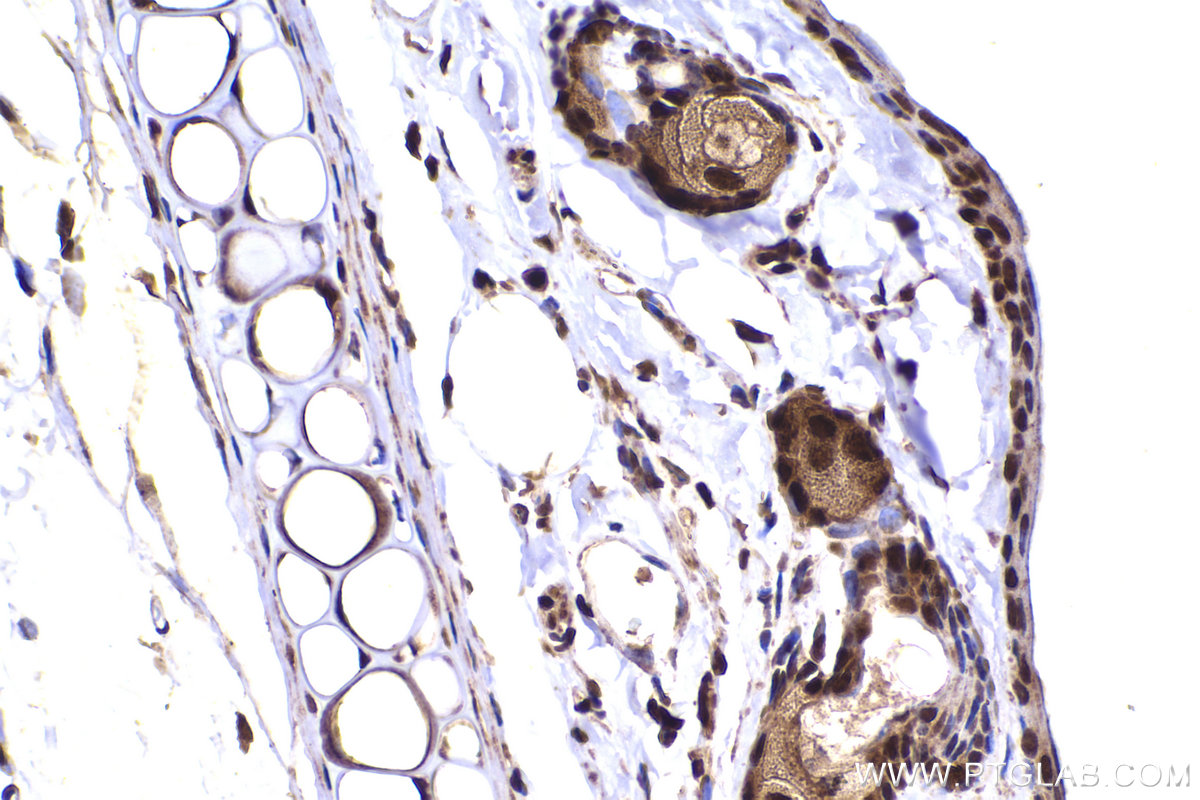 Immunohistochemical analysis of paraffin-embedded rat skin tissue slide using KHC2256 (FEN1 IHC Kit).