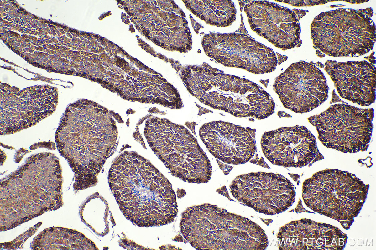 Immunohistochemical analysis of paraffin-embedded mouse testis tissue slide using KHC2397 (FMR1 IHC Kit).