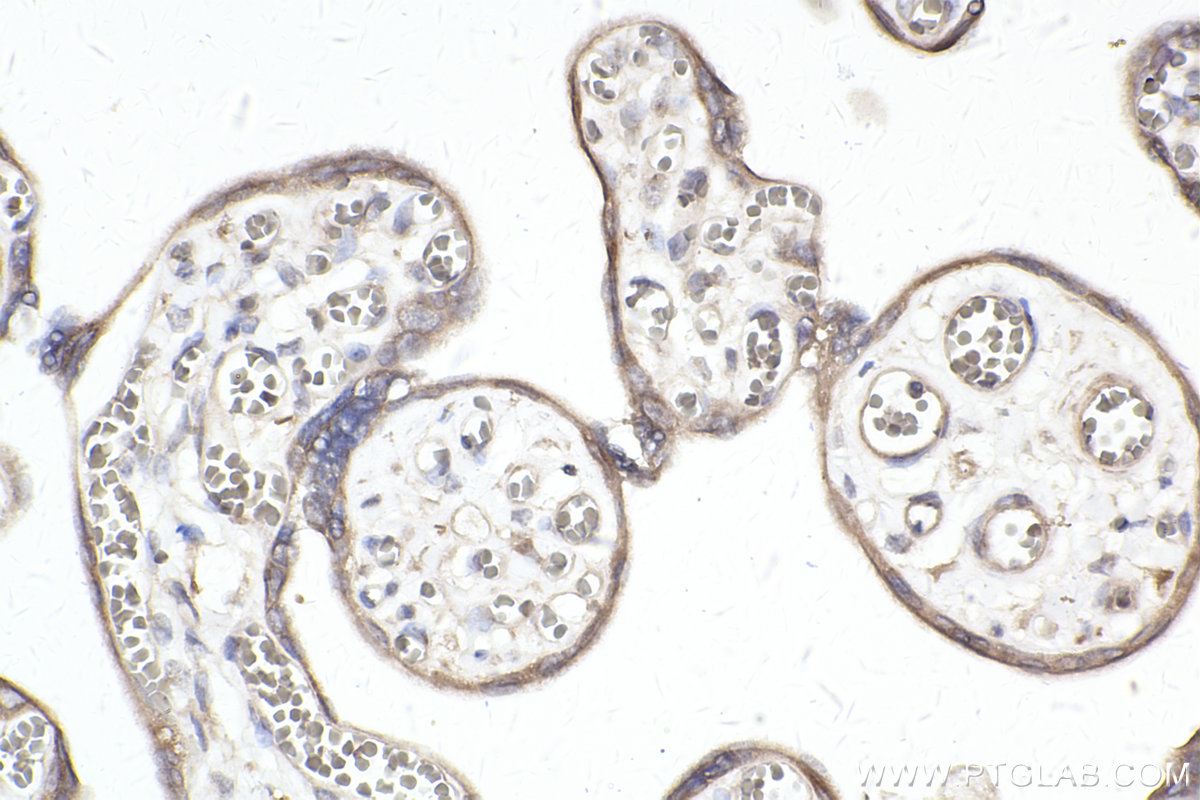 Immunohistochemical analysis of paraffin-embedded human placenta tissue slide using KHC2397 (FMR1 IHC Kit).