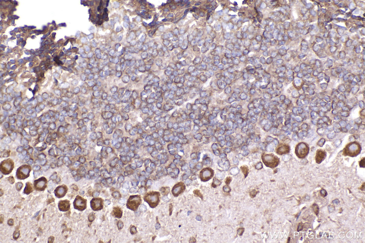 Immunohistochemical analysis of paraffin-embedded mouse cerebellum tissue slide using KHC2300 (FXR2 IHC Kit).