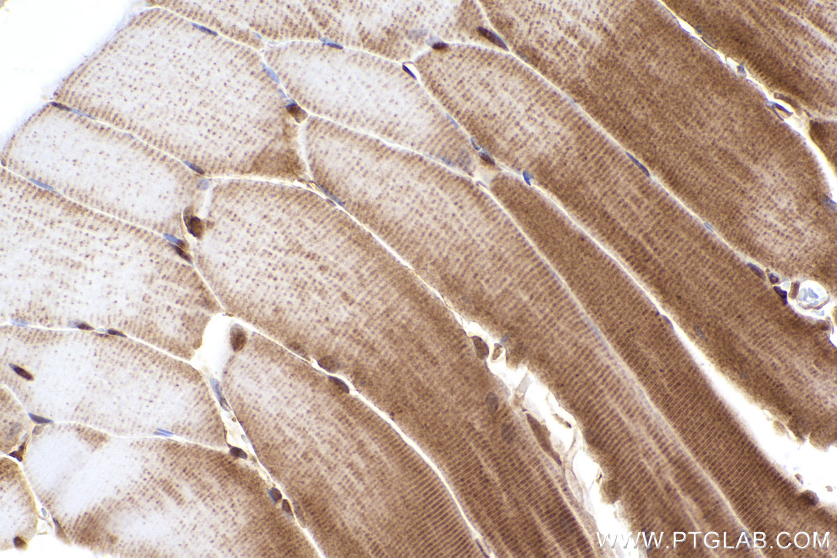 Immunohistochemical analysis of paraffin-embedded rat skeletal muscle tissue slide using KHC2416 (Flightless I IHC Kit).