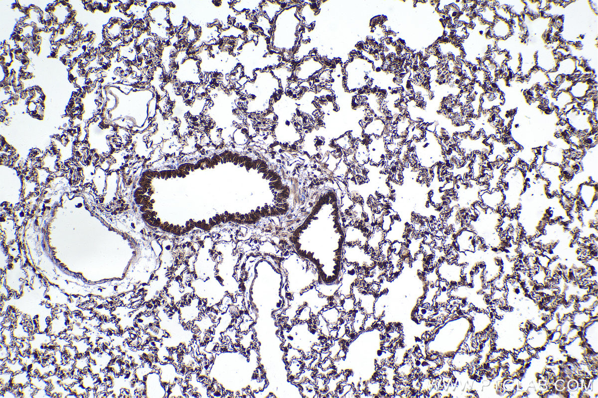 Immunohistochemical analysis of paraffin-embedded rat lung tissue slide using KHC2416 (Flightless I IHC Kit).