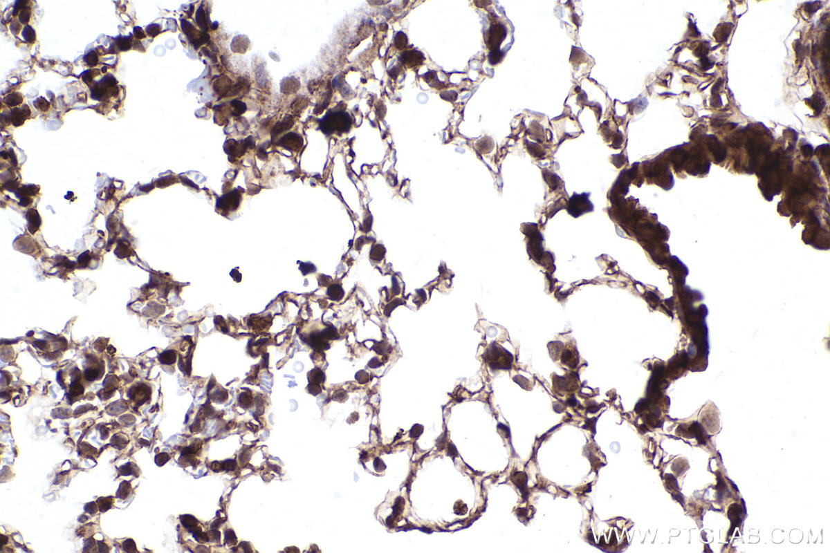 Immunohistochemical analysis of paraffin-embedded mouse lung tissue slide using KHC2416 (Flightless I IHC Kit).