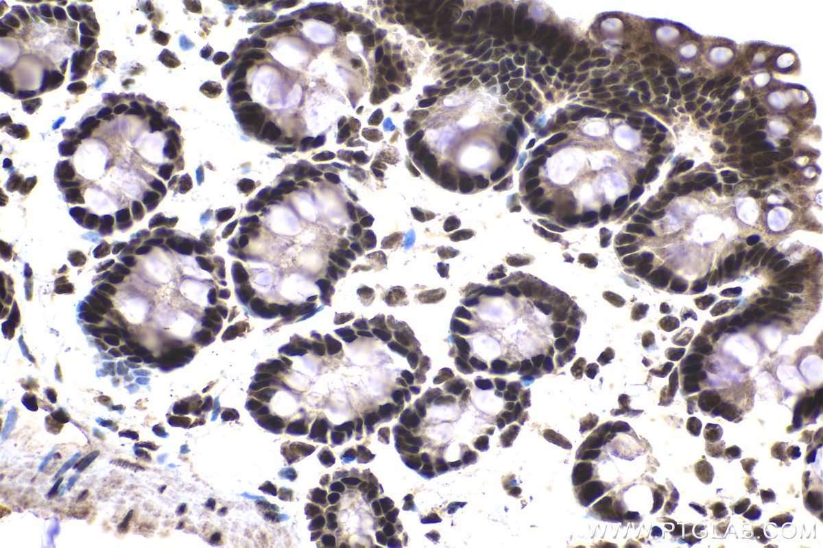 Immunohistochemical analysis of paraffin-embedded rat colon tissue slide using KHC1384 (GABPB1 IHC Kit).