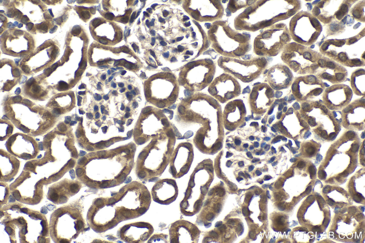 Immunohistochemical analysis of paraffin-embedded mouse kidney tissue slide using KHC1464 (GANP IHC Kit).