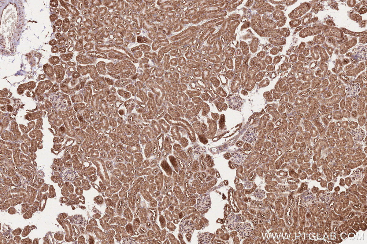 Immunohistochemical analysis of paraffin-embedded mouse kidney tissue slide using KHC2601 (GIGYF2 IHC Kit).