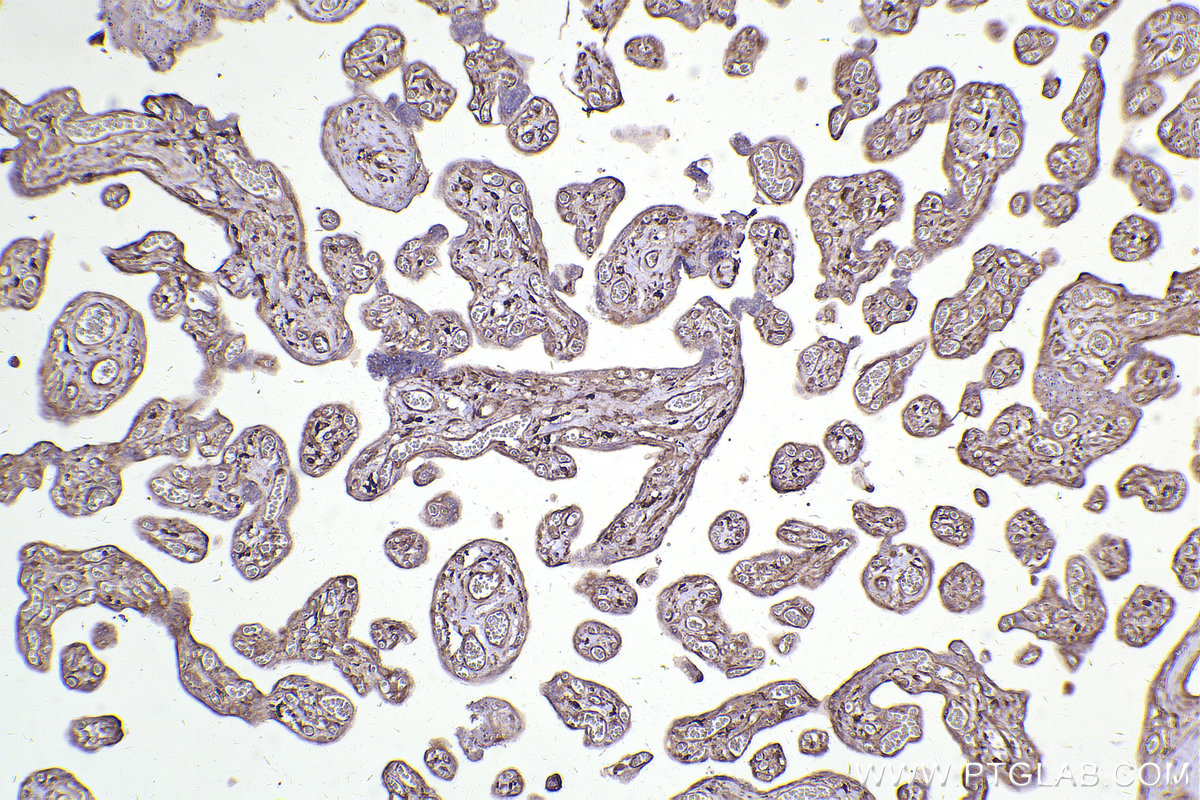 Immunohistochemical analysis of paraffin-embedded human placenta tissue slide using KHC2451 (GIT2 IHC Kit).