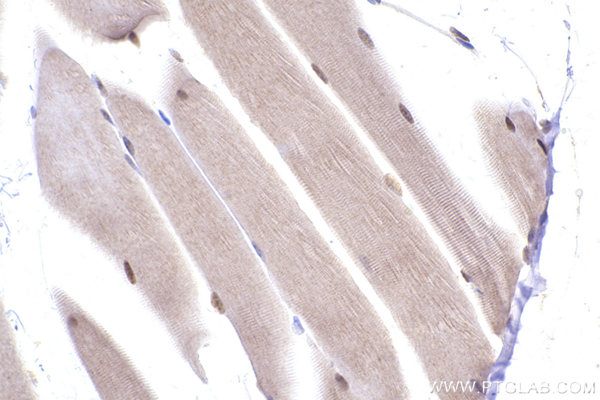 Immunohistochemical analysis of paraffin-embedded mouse skeletal muscle tissue slide using KHC2417 (GPS1/CSN1 IHC Kit).