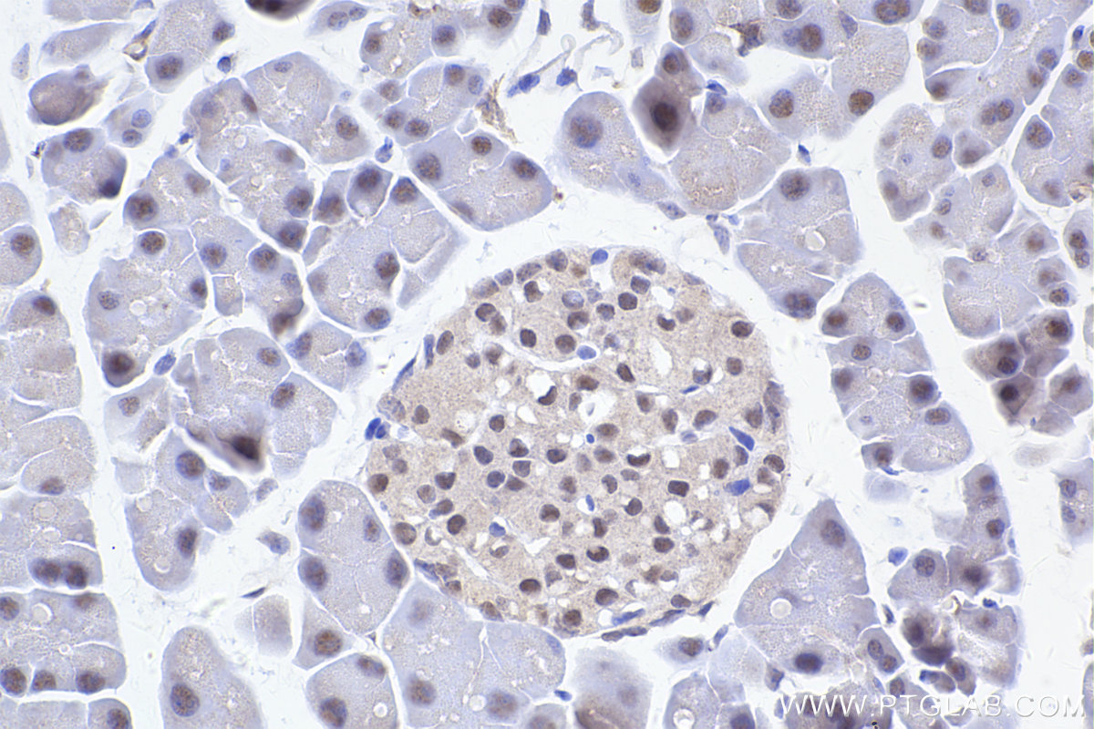 Immunohistochemical analysis of paraffin-embedded mouse pancreas tissue slide using KHC2417 (GPS1/CSN1 IHC Kit).